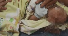 Bayi Deriana Laia di Kota Padang Sidempuan Butuh Uluran Tangan Dermawan