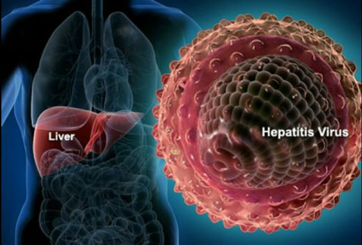 Di 4 Daerah, 208 Orang Positif Hepatitis B